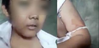 Video Bocah SD Menampakan Luka Lebam Viral di Sosmed