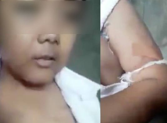 Video Bocah SD Menampakan Luka Lebam Viral di Sosmed
